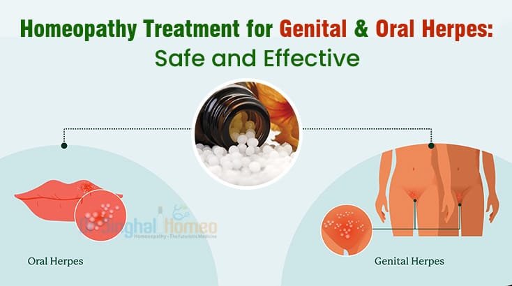 Types of Herpes | Oral, Genital & More | Dr. Singhal’s Guide