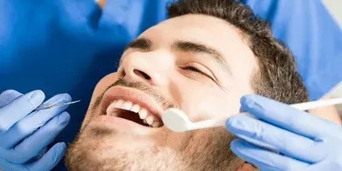 Dental Veneers in Islamabad – Get the Perfect Smile at Enfield Royal Clinic