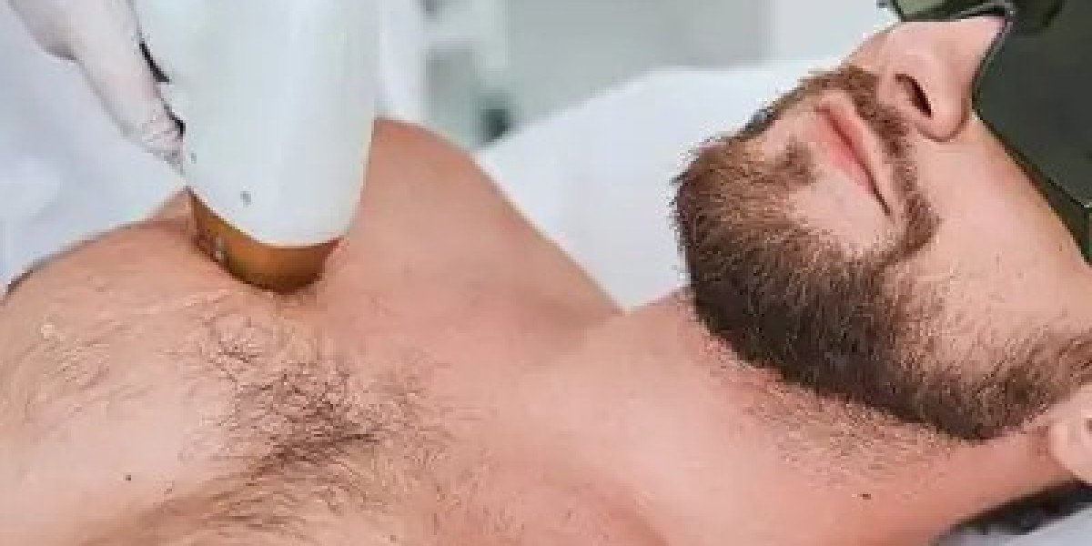 Laser Hair Removal in Islamabad – Your Complete Guide to Smooth, Hair-Free Skin at Enfield Royal Clinic