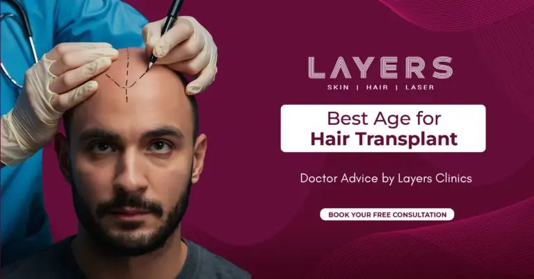 Best Age for Hair Transplant | Doctor Advice (2026)