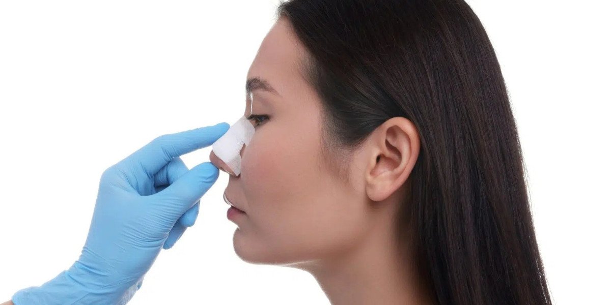 The Importance of Choosing Expert Care for Rhinoplasty in Islamabad