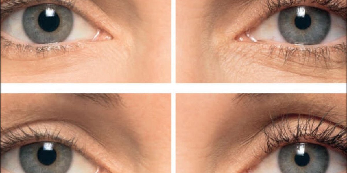 Skin Effect Sherwood Park – Advanced Laser & Medical Aesthetics by Ali Aesthetics MD