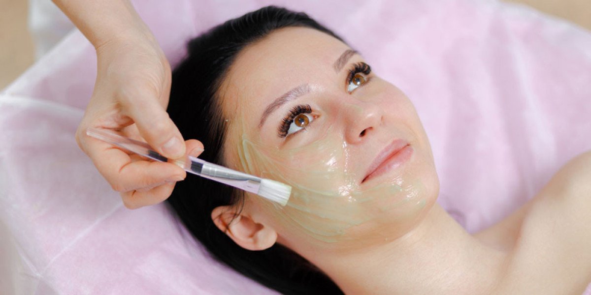 What Is a Chemical Peel? A Complete Guide for Croydon Patients