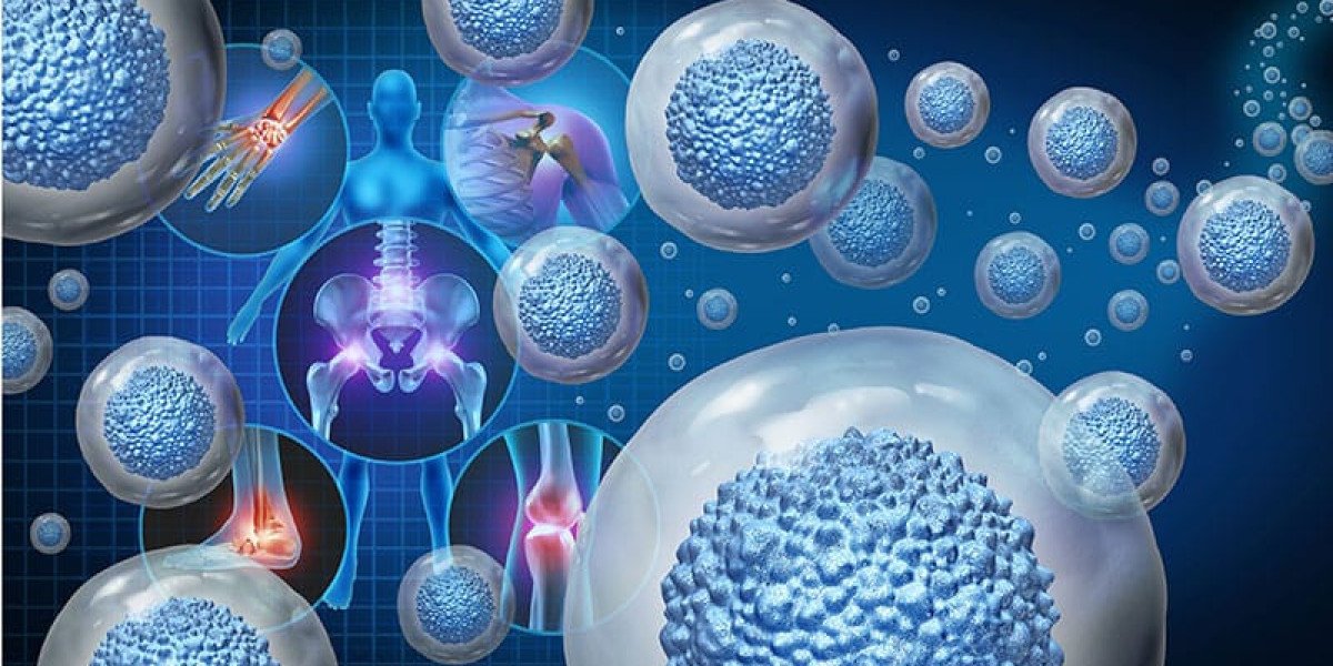Stem Cell Therapy for Kidney Failure in UAE and Sports Recovery