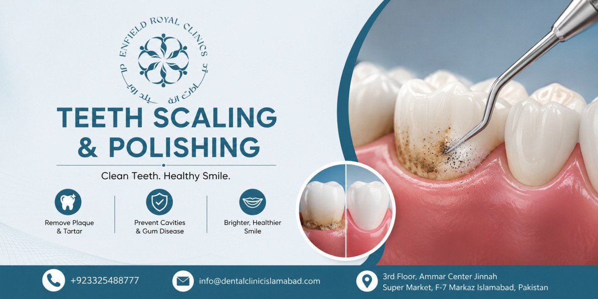 Reliable Teeth Scaling and Polishing in Islamabad