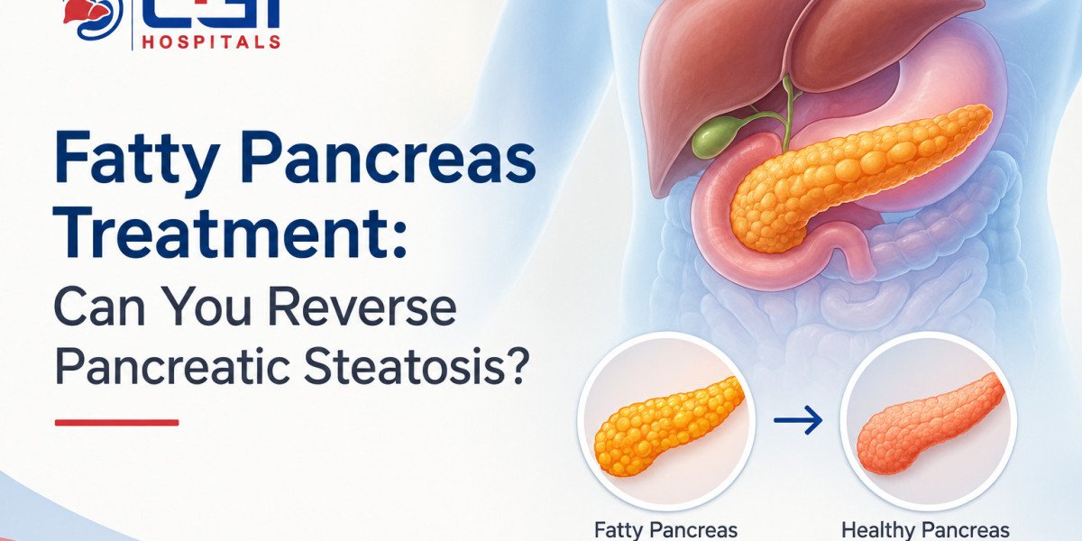 Fatty Pancreas Treatment: Can You Reverse Pancreatic Steatosis?