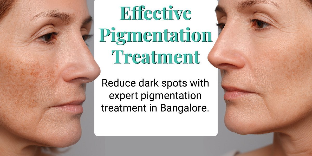 Why Does Your Pigmentation Keep Coming Back? Understanding the Real Cause